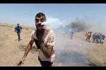 بتوجيهات ملكية.. نقل مصاب من غزة أصيب بقنبلة دخانية إلى المدينة الطبية