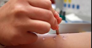 دراسة تؤكد القدرة تشخيص السكري عن طريق فحص الجلد