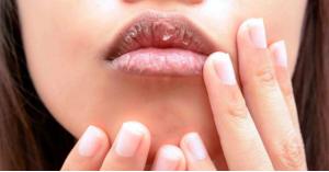 دراسة: جفاف الفم ينذر بإصابتك بهذا المرض الخطير