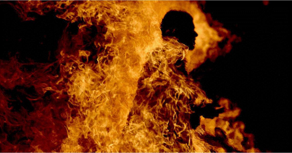شاب يحرق شقيقه في اربد