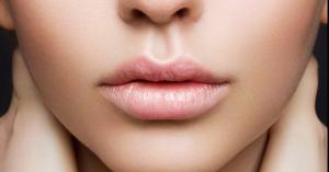 طرق فعالة لعلاج الجلد الداكن حول الفم