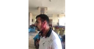 عائلة اردنية تتعرض "لاعتداء وحشي" بصواعق كهربائية في طابا (صور)