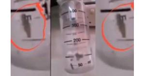 تحقيق بفيديو يظهر حشرة داخل جهاز طبي بمستشفى