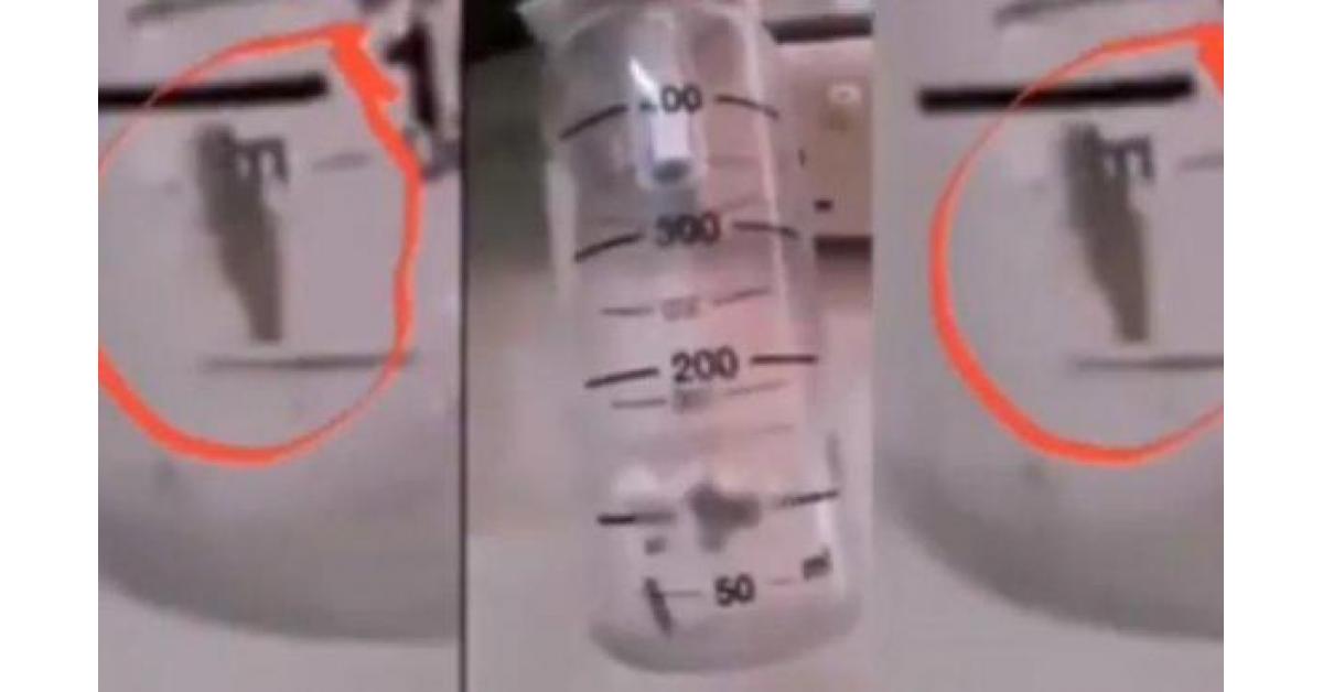 تحقيق بفيديو يظهر حشرة داخل جهاز طبي بمستشفى