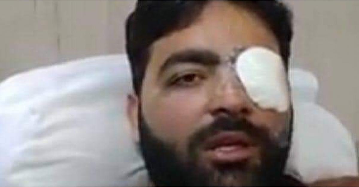 "صحفي" يفقد عينه اليسرى بسبب رصاص الاحتلال.. صور