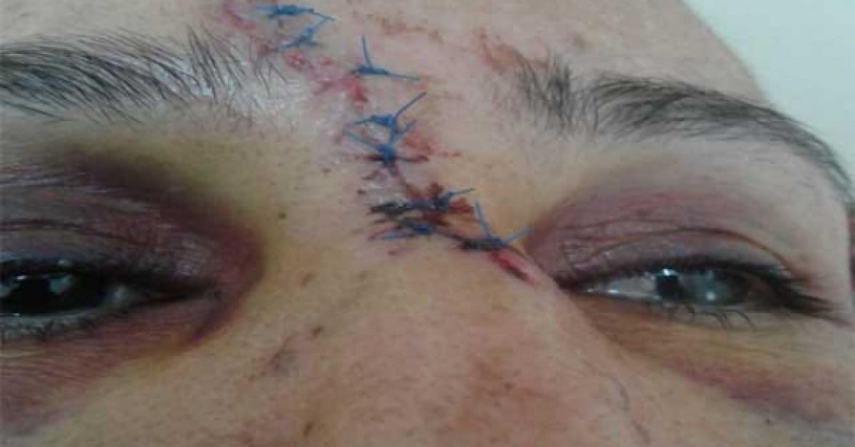 ضرب امرأة ثلاثينية بوحشية غير مسبوقة و نقلها للمستشفى