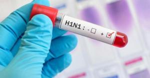 الصحة: انفلونزا الخنازير اعتيادية ولا داع للقلق