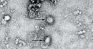 ماذا نعرف عن فيروس كورونا؟