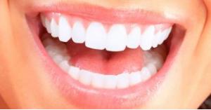 في حالة نادرة.. نمو شعيرات في أسنان سيدة (صورة)