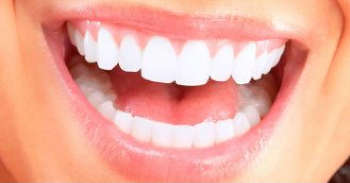 في حالة نادرة.. نمو شعيرات في أسنان سيدة (صورة)