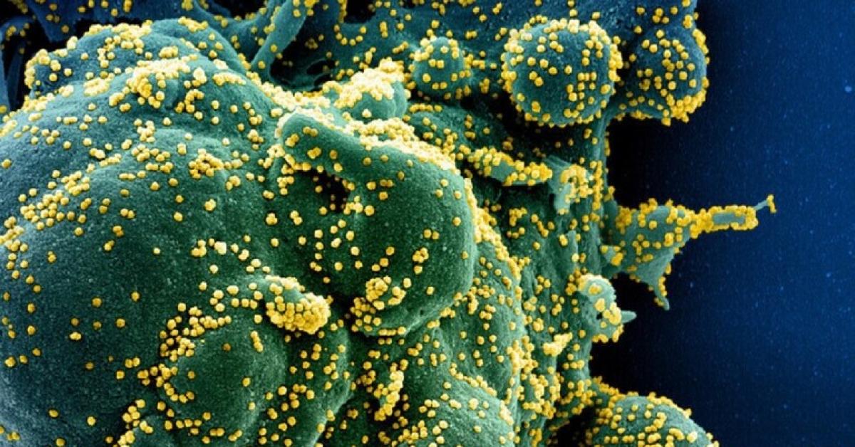 علماء يعثرون على "كعب أخيل" لفيروس كورونا