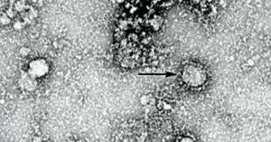 دراسة تقلب الموازين حول منشأ فيروس كورونا وتبرئ الصين