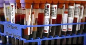 علماء يكشفون فصيلة الدم الأكثر خطورة